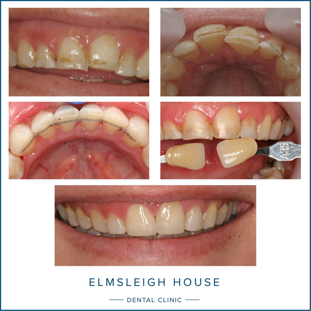 ABC dentistry Align, Brighten and Contour